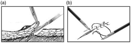 Figure 1. Surgical tasks: (a) peeling tissue and (b) intracorporeal knot tying.