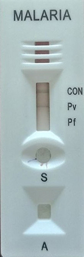 Figure 2 RDT test showing positive P. vivax result.