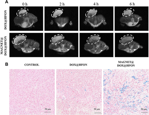 Figure 7 (A) MRI T2-weighted imaging of mice in DOX@HFON and MAGNET@DOX@HFON groups before and after drug injection; (B) Prussian blue staining of transplanted tumor sections of mice in different groups.