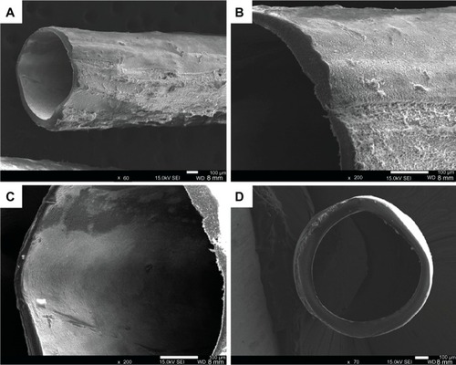 Figure 7 SEM images of a Fbg microtube. (A) The outer morphology of the tube shows the rough surfaces; (B) Magnified image of microtube shown in (A); (C) The tube’s inner surface was revealed to be much smoother than the outer surface; (D) The cross-sectional SEM image reveals the round shape, with approximately uniform wall thickness. (data unpublished).Abbreviations: Fbg, fibrinogen; SEM, scanning electron microscope.