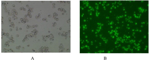 Figure 1. The hepatocytes incubating with (A) and without (B) QBT, observed in the microscope (×10).