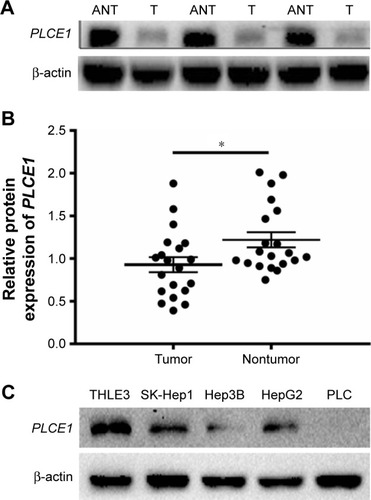 Figure 2 Western blotting analysis of PLCE1 expression in tissues from HCC tumorous tissues or cell lines and adjacent nontumorous tissues or normal liver epithelial cells.