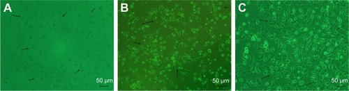 Figure 1 Morphological changes in endothelial progenitor cells (EPCs) sourced from bone marrow of C57BL/6J mice during culture.Notes: (A) Representative microscopy of EPCs cultured with endothelial growth medium 2 in the presence of 5% fetal bovine serum on day 1. EPCs formed were spherical, cell sizes were almost the same, and cells were suspended in the culture medium. (B) On day 4 of the culture, the cells were attached to one other, getting larger, and became oval, spindly, or polygonal. (C) On day 7 of the culture, the cells became fusiform or polygonal in pattern. EPCs contacted one another to attempt to form capillary structures (arrows). Magnification ×100.