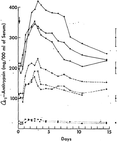 Figure 2. Changes in AAT levels of serum following the intravenous injection of 0.2 ml typhoid-paratyphoid vaccine (arrow) in the genetically different individuals. Homozygotes for common gene: solid line, heterozygotes for AATD gene: dashed line, homozygotes for deficiency gene: dotted line. At the right: standard error of the method.Reproduced from Kueppers, Humangenetik 1968;6:207-14 [Citation14]