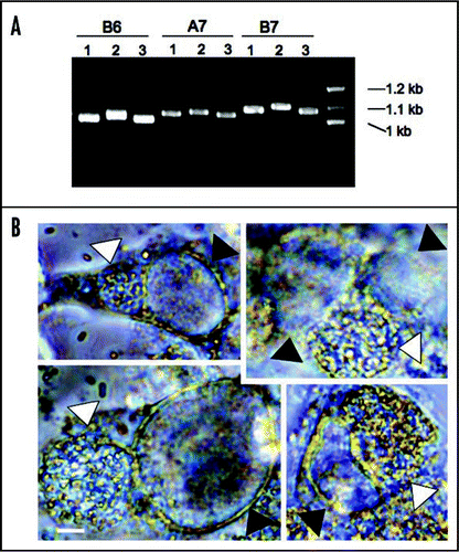 Figure 3 Genetic variation of tandem repeat DNAs in different E. cuniculi isolates and co-infection of E. cuniculi and C. trachomatis. (A) Examples of TR DNAs. Three E. cuniculi isolates (1 is for EC1, 2 for EC2 and 3 for EC3) have different sized banding patterns. B6, A7 and B7 are TR areas chosen with the Tandem Repeat Finder (see the text). (B) E. cuniculi and C. trachomatis infect the same host cell forming two independent parasitophorous vacuoles. White arrowheads indicate E. cuniculi vacuoles and black arrowheads indicate C. trachomatis vacuoles. Scale = 5 µm.