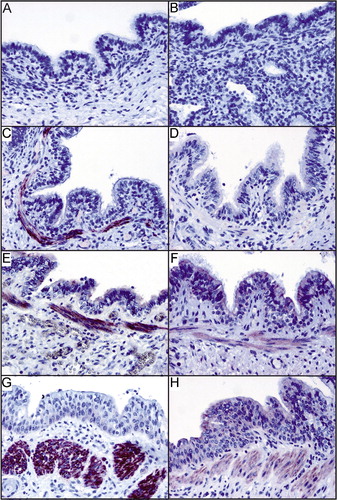 Figure 1. Immunohistochemical analysis of paraffin‐embedded specimens of fetuses (A, B), term infants without lung injury (C, D) and preterm infants with respiratory distress syndrome (RDS) (E, F) or bronchopulmonary dysplasia (BPD) (G, H) with the GPRA‐A (left panel) and ‐B isoform (right panel) specific antibodies. GPRA‐A and ‐B expression in the bronchial epithelium is absent in fetal samples and is induced in term samples. GPRA‐A is additionally expressed in the smooth muscle cells of the bronchioles. GPRA‐B expression is upregulated in the smooth muscle cells of the bronchioles in RDS and BPD.
