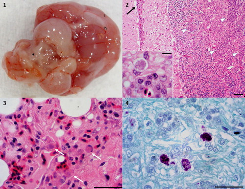 Figure 1. (1) Coxiellosis in a 12-month-old, male budgerigar (case 5). Gross image of the fresh brain tissue, ventral view, showing alternating meningeal hyperaemia (h) and clouding (i; interpreted as inflammation). There is malacia (softening to liquefaction) of the cerebellum, resulting in an irregular surface (*). Photo courtesy of Lauren V Powers, DVM, DABVP. Service Head, Avian and Exotic Pet Service, Carolina Veterinary Specialists,12117 Statesville Road, Huntersville, North Carolina 28078. (2) Coxiellosis in a 12-month-old, male budgerigar (case 5). Haematoxylin and eosin stain, brain, 40×. Meningoencephalitis characterized by increased cellularity of the meninges (black arrow) and the white and grey matter of the brain itself (arrowheads). Bar = 65 µm. Inset – higher magnification showing an infected cell. 400×, bar = 15 µm. (3) Coxiellosis in a male Swainson’s lorikeet (case 6). Haematoxylin and eosin stain, lung, 400×. There is increased cellularity of the interstitium. There are multiple infected cells denoted by the white arrows. Bar = 30 µm. (4) Coxiellosis in a male Swainson’s lorikeet. Gimenez histochemical stain, 400×. The infectious organisms are azurophilic intracytoplasmic inclusions in the infiltrating macrophages. Bar = 30 µm.