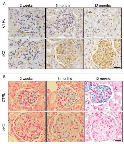 Figure 6. Endothelial-specific autophagy-deficient mice exhibit GEnC injury. Representative images of staining for ICAM1 (A) and colloidal iron (B) in the Atg5-CTRL and atg5-cKO mice at the indicated ages after rescue by BMT at 4 wk of age (Atg5-CTRL recipients and atg5-cKO recipients, respectively). Bars: 20 μm.