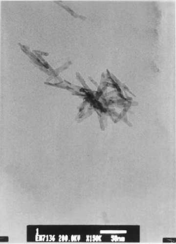 Figure 4. TEM image of the CuO nanowhiskers sample Citation27.