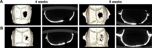 Figure 9 3D reconstruction and micro-CT images of new bone regeneration after 4 and 8 weeks.Note: The 3D reconstructions and the coronary sections of rat craniums in (A) the control and (B) the 50 mg ACS-CCM group after being implanted for 4 and 8 weeks.Abbreviations: micro-CT, micro-computed tomography; ACS-CCM, aspirin-loaded chitosan nanoparticles contained in collagen-chitosan membranes.