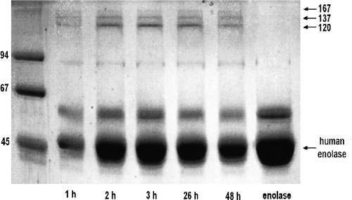Figure 4.  Formation of high molecular weight derivatives of human muscle enolase by methylglyoxal glycation. Samples of 15 μM enolase after preincubaton in PBS pH 7.4, at 37°C for 30 min were modified with 4.34 mM methylglyoxal at various times (1 h, 2 h, 3 h, 26 h, 48.5 h). The reaction was stopped by addition of an excess of lysine to bind unreacted methylglyoxal. Pre-stained protein standards are marked in the left lane and unmodified enolase is in the right lane. Arrows indicate enolase advanced glycation end products and unmodified enzyme.