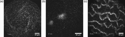 Figure 13. Depending on the filament density different dynamic patterns emerge when actin filaments move over a myosin-coated surface. Few characteristic examples are shown here: swirl (a), swarm (b), and waves (c). Figure was adapted from Citation5 (with permission from Volker Schaller and Macmillan Publishers Ltd: Nature Reviews Neuroscience 467, 2010).