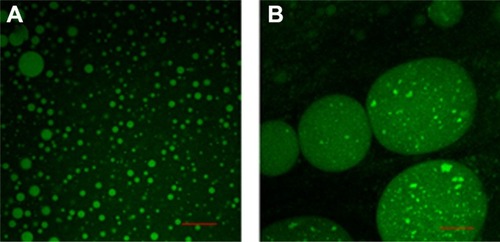 Figure 2 (A) Confocal microscopy images of freshly prepared sodium fluorescein-SDEDDS and (B) formulated fine w/o/w double emulsions after 2-minute dilution with dispersion medium.Note: Scale bar represents 30 μm.Abbreviation: SDEDDS; self-double-emulsifying drug delivery system; w/o/w, water-in-oil-in-water.
