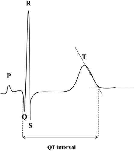 Figure 1. The length of the QT interval was obtained by identifying the QRS onset and the point at which the downward slope of the T wave returns to baseline.