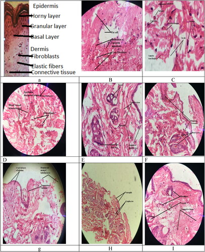 Figure 8. (a) Normal rabbit skin tissue histology; (b–e) excised capsicum treated rabbit skin tissues; (f, g) 40× power, enlarged view, (h) 10× power, (i) excised CPM niosomal gel treated rabbit skin tissues stained with haematoxylin and eosin (high magnification).