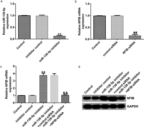 Figure 7. Effects of miR-138-5p inhibitor on NFIB levels in SH-SY5Y cells. SH-SY5Y cells were transfected with the control inhibitor, miR-138-5p inhibitor, control-siRNA, or NFIB-siRNA. Expression of miR-138-5p (a) and NFIB (b) was examined using qRT-PCR in SH-SY5Y cells. qRT-PCR and western blot analysis (c and d) of NFIB expression in SH-SY5Y cells