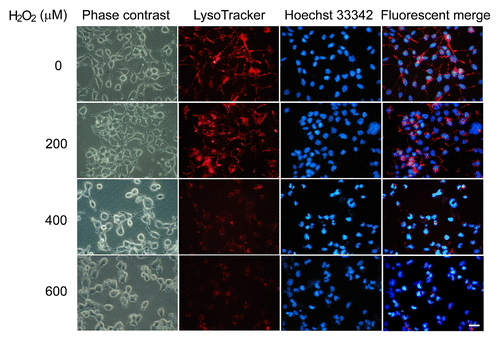 Figure 8. Excessive oxidative stress induces lysosome rupture. SK-N-SH cells were treated in the absence or presence of H2O2 (0 to 600 μM) for 24 h. Cells were then visualized by bright-field microscopy or stained with LysoTracker Red (50 nM) or Hoechst 33342 (10 μg/ml) and subjected to immunofluorescence imaging. Scale bar: 25 μm.