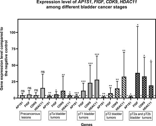 Figure 2. Expression levels of the AP1S1, FIGF, CDK9 and HDAC11 genes among the tested clinical groups in terms of tumor stage (Precancerous, pTa, рТ1, рТ2, pT2a and pT2b). The average expression levels of the tested genes are shown. Dashed line marks cut-off value of 4-fold change in gene expression. Error bars show standard deviation of the means. The distinct clinical groups are four groups of uroepithelial carcinoma: stage pTa, pT1, pT2, pT2a and T2b as well as a group of tumor lesions from a chronic inflammatory process (Precancerous lesion); ”*” indicates a P-value less than 0.05, “**” indicates a P-value less than 0.01 and “***”indicates a P-value less than 0.001 for one-sample Wilcoxon test.