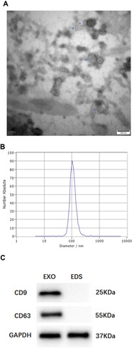 Figure 1 Characterization of serum exosome. (A) Serum exosomes (arrows) were analyzed by TEM. (B) NTA revealed the particle size, ranging from 50–150 nm in diameter. (C) Exosome-enriched protein CD9 and CD63 were analyzed by Western blotting in exosomal (EXO) and exosome-depleted supernatant (EDS) samples in serum.