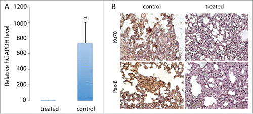 Figure 4. Inhibition of TSG-RCC-030 lung metastasis by cabozantinib. The level of human GAPDH in the lung tissue of control mice was significantly higher than in cabozantinib-treated mice as assessed by qPCR using human-specific GAPDH primers (A). Tumor cells expressing human-specific nuclear antigen Ku70 were detected only in control but not treated mice (B). These metastatic tumor cells also expressed Pax-8, a typical marker of pRCC (B). Data points represent mean+/− SD. *p < 0.05 by Student's t-test. Magnification of images is 200×.