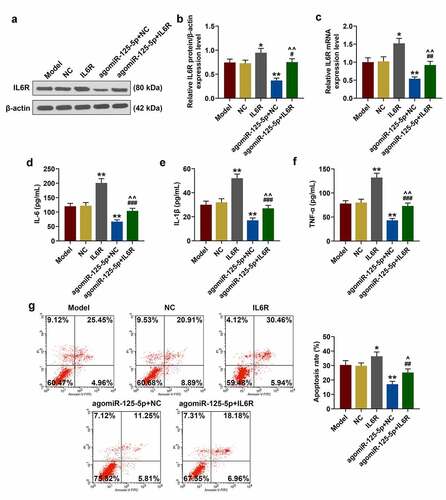 Figure 4. Effect of IL-6 R overexpression on co-culture system of monocyte cells (THP-1) and human intestinal epithelial cells (NCM460). (a-c) After co-culture of THP-1 and NCM460 for 24 hours, the expression of IL-6 R in THP-1 cells of Model, NC, IL-6 R, agomiR-125-5p+NC, agomiR-125-5p+IL-6 R group was detected by reverse transcription real-time quantitative polymerase chain reaction (RT-qPCR) and Western blot. (d-f) Enzyme-linked immunosorbent assay (ELISA) was used to determine the contents of interleukin-6 (IL-6), IL-1β and tumor necrosis factor-α (TNF-α) in the supernatant of medium in each group. (g) After 24-h co-culture of THP-1 and NCM460, the apoptosis of NCM460 cells in each group was detected by flow cytometry. All the experiments have been performed in triplicate. β-actin was used as a control. * P < 0.05, ** P < 0.01 vs. NC; #P < 0.05, ## P < 0.01, ### P < 0.001 vs. IL-6 R; ^ P < 0.05, ^^ P < 0.01 vs. agomiR-125-5p+NC