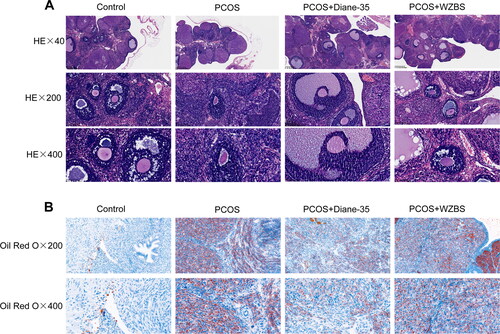 Figure 3. WZBS recipe ameliorated ovary histopathological injuries of PCOS rats. (A) The representative images of ovarian tissue of rats stained with HE (×40, ×200, ×400, respectively). (B) The representative images of ovarian tissue of rats stained with oil red O (×200, ×400, respectively). n = 3.