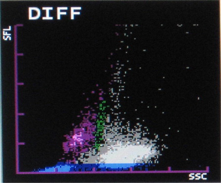 Figure 1. Graying of eosinophil and neutrophil groups.