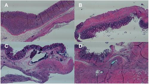 Figure 10 Histological images of the experimental group (with membranes) on (A) day 1, (B) day 3, and (C) day 7, and the control group (without membranes) on (D) day 7 (Scale bar: 1 mm).