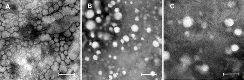 Figure 4 TEM images of NLC (A), B-rLips (B) and FB-rLips (C). The bar of B is 500 nm. The bar of A and C are 200 nm.