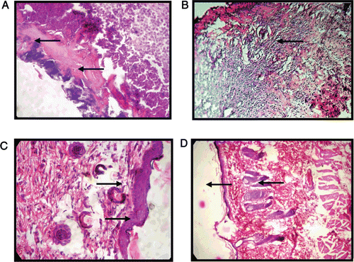 Figure 2.  Photomicrograph showing histopathological changes of the granulation tissues in burn wound in rats, (A) Control group showing necrotic debris (H&E × 100), (B) MEAA-treated group showing collagen deposition (Vangiesons × 100), (C) MEAA-treated group showing collagen and fibroblast proliferation and formation of epidermis (H&E×100) and, (D) Himax-treated standard group showing congestion, development of epidermis and keratin layer (H&E × 100).