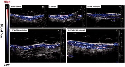 Figure 5. Cross-sectional combined ultrasound and photoacoustic images of diabetic wound for blood flow detection at day 28.