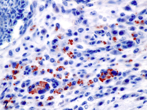Figure 7.  Immunohistochemistry of tongue, Eclectus parrot (E. roratus). Intrahistiocytic yeasts are strongly positive for H. capsulatum markers. 600x magnification.