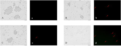 Figure 4 Fluorometric analysis of metacaspase activity. CA10 cells with FITC-VAD-FMK staining were observed under a fluorescent microscope after treatment with FLC (1 μg/mL), LEF (64 μg/mL), and a combination of FLC (1 μg/mL) with LEF (64 μg/mL). CA10 cells without drug treatment were used as the control. The photographs were collected from the most representative example in three independent experiments. (A, a) Control; (B, b) Cells exposed to FLC; (C, c) Cells exposed to LEF; (D, d) Cells exposed to FLC+LEF.