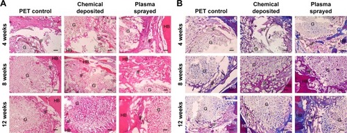 Figure 8 Representative images of bone–graft IF at 4, 8, and 12 weeks post surgery.Notes: (A) H&E staining results for the graft–bone IF of the PET control, chemical-deposited, and plasma-sprayed groups. (B) Masson trichrome staining showing fibrocartilage formation between the bone and grafts. Bar =100 μm.Abbreviations: IF, interface; H&E, hematoxylin–eosin; PET, polyethylene terephthalate; G, grafts; HB, host bone.