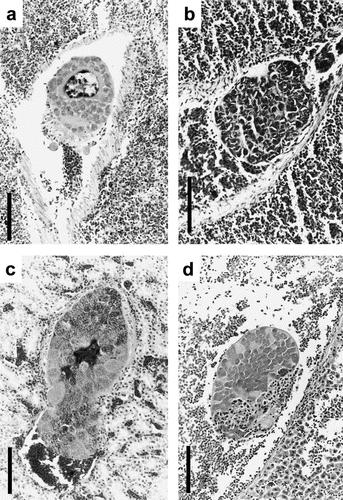 Fig. 1 Schizonts from species of Artamidae. 1a: Gymnorhina tibicen (Australian Magpie) spleen with schizont with central body and cytomeres in vessel. 1b: G. tibicen with schizont causing embolism in the spleen. 1c: Strepera graculina (Pied Currawong) kidney with large schizont and prominent cytomeres. 1d: Cracticus torquatus (Grey Butcherbird) liver with developing schizont in hepatic vessel. All scalebars, 100 μm, and tissue sections stained with HE.