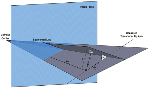Figure 3. Back-projection of a segmented line and its comparison to the transducer tip axis measured by EMT. [Color version available online.]