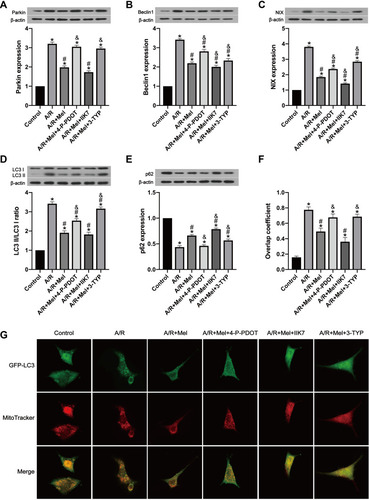 Figure 4 Melatonin alleviated A/R injury in H9c2 cells by inhibiting mitophagy, but these effects were inhibited by 4-P-PDOT or 3-TYP and enhanced by IIK7. (A) Parkin expression. (B) Beclin1 expression. (C) NIX expression. (D) LC3 II/LC3 I ratio. (E) p62 expression. (F) Manders’ overlap coefficient for GFP-LC3 and mitochondria. (G) Colocalization of GFP-LC3 and MitoTracker. Fluorescence images were obtained by confocal microscopy. Data are described as the mean ± SEM (n=6 in each group). *P < 0.05 vs the control group; #P < 0.05 vs the A/R group; &P < 0.05 vs the A/R + Mel group.