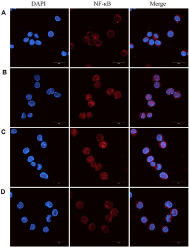 Figure 10 Berberine (BBR)-NLCs blocked LPS-induced NF-κB nuclear translocation.Notes: (A) Untreated RAW264.7 cells. (B) RAW264.7 cells treated with LPS (100 ng/mL) for 6 h. (C) RAW264.7 cells pretreated with BBR (5 μg/mL) for 2 h, then treated with LPS (100 ng/mL) for 6 h. (D) RAW264.7 cells pretreated with BBR-NLCs (5 μg/mL) for 2 h, then treated with LPS (100 ng/mL) for 6 h. The translocation of NF-κB was determined using immunofluorescence. For all experiments, n = 3, and the scale bar = 20 µm.