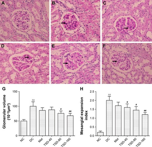 Figure 5 Representative micrographs of kidney tissue stained with periodic acid–Schiff.