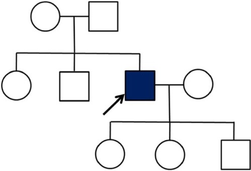 Figure 1 Family tree of the AD patient with R62C mutation.