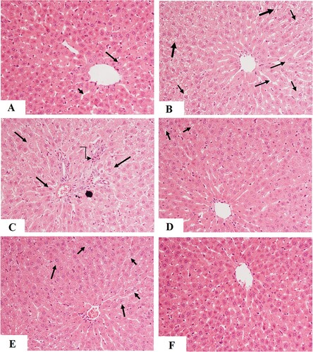 Figure 5. Histological features in the livers of all groups of rats as stained with hematoxylin and eosin (H&E) (200x). A: was taken form a control rat and showed normal liver architecture with normally sized hepatocytes (long arrow) radiating from a central vein with intact normal-sized sinusoids (short arrow). B and C: were taken from streptozotocin-induced diabetic rats (DM1) and showed small central vein, swelled (long arrow), and damaged (short arrow) hepatocytes. Lipid accumulation was evident in most of the hepatocytes with the appearance of lipid vacuoles (Red arrow) and inflammatory cells (Curved arrow). D, E, and F: were taken from DM1 + glimepiride (GLB), DM1 + Aloe perryi (AP) (150 mg/Kg), and DM1 + Aloe perryi (AP) (300 mg/Kg)-treated rats and showed much improvement in the structure of the hepatocytes. However, few fat vacuoles (short arrow) and less damaged hepatocytes (long arrow) are still observed in DM1 + glimepiride (GLB) and DM1 + Aloe perryi (AP) (150 mg/Kg)-treated groups. Almost normal liver structure was observed in DM1 + AP300-treated rats.