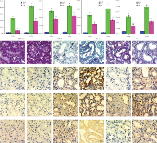 Figure 1.  (1) Statistical parameters in three groups. (2) Tissue characteristics of renal interstitium in three groups. Masson staining for SHO group (A1, 14-day and A2, 28-day), GU group (A3, 14-day and A4, 28-day) and GU group (A5, 14-day and A6, 28-day). Representative samples of immunohistochemical staining for TGF-β1 (SHO: B1, 14-day and B2, 28-day, GU: B3,14-day and B4, 28-day; and GA B5,14-day and B6, 28-day), Col-IV (SHO: C1, 14-day and C2, 28-day and GU: C3,14-day and C4: 28-day; GA: C5,14-day and C6, 28-day) and FN (SHO: D1, 14-day and D2, 28-day, GU: D3,14-day and D4, 28-day; and GA: D5,14-day and D6, 28-day) were observed in all groups. Positive stainings for collagen fibers (blue, masson’s trichrome staining) in GU group was notably marked than that in SHO group and ATRA group. Positive staining for TGF-β1, Col-IV or FN was strong in GU group when compared with that in SHO. The positive stainings in ATRA group were remarkably reduced when compared with those in GS group. TGF-β1, transforming growth factor-β1; Col-IV, collagen IV; FN, fibronectin; ATRA, all-trans retinoic acid; SHO, sham operation group; GU, model group subjected to unilateral ureteral obstruction, GA, model group treated with ATRA. Magnification 400x.Note: *p < 0.01 compared with SHO, **p < 0.01 compared with GU.