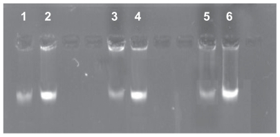 Figure 3 Effect of S-T-Gel on genome DNA of bacterial cells.Note: 2, 4, and 6 denote genome DNA of normal Staphylococcus aureus, Escherichia coli, and Pseudomonas aeruginosa cells respectively. 1, 3, and 5 denote genome DNA of S. aureus, E. coli, and P. aeruginosa cells treated with 10 μg/mL S-T-Gel respectively.Abbreviations: DNA, deoxyribonucleic acid; S-T-Gel, silver nanoparticles incorporated into thermosensitive gel.