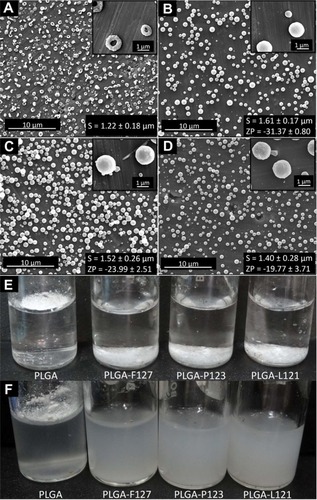 Figure 1 Scanning electron micrographs of electrosprayed microparticles (A–D), and digital images of PLGA, PLGA-F127, PLGA-P123, and PLGA-L121 microparticles dispersions in water (E–F). (A) PLGA microparticles. (B) PLGA-Pluronic® F127 microparticles. (C) PLGA-Pluronic® P123 microparticles. (D) PLGA-Pluronic® L121 microparticles. Low magnification images: scale bar 10 μm; insets (top right) are high magnification images: scale bar 1 μm; insets (bottom right) S and ZP represented as mean ± standard deviation in μm and mV, respectively. (E) Before sonication. (F) After sonication.Abbreviations: PLGA, poly(lactide-co-glycolide); S, size; ZP, zeta potential.