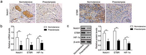 Figure 1. Notch1 and ETBR are down-regulated in placentas of PE patients. (a) Representative images of immunohistochemistry analysis of Notch1 and ETBR expression in placentas from normal pregnant women and PE women. (b) RT-qPCR analysis of Notch1 and ETBR in placentas from normal pregnant women and PE women. (c) Western blot analysis of Notch1 and ETBR in placentas from normal pregnant women and PE women. * P< 0.05; ** P< 0.01.
