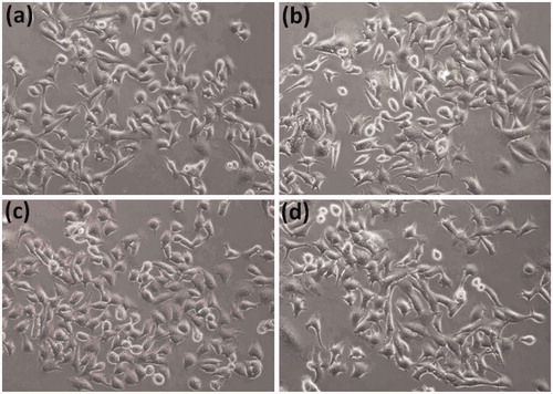 Figure 6. The B16F10 cells morphology. The cells were incubated with (a) cell culture medium, (b) 3 µg/ml, (c) 6 µg/ml, and (d) 12 µg/ml concentrations of 5c for 24 h and then cell images were taken by inverted fluorescent microscope (Nikon, ECLIPSE, Ti, Tokyo, Japan).