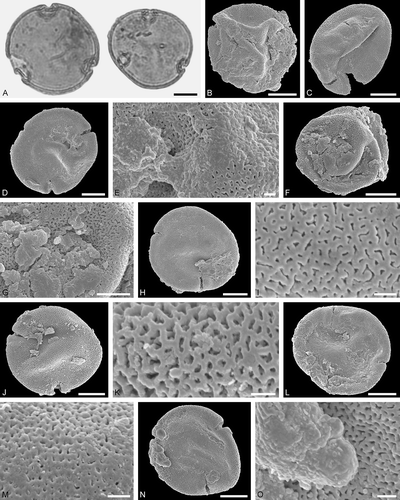 Figure 4. Associated pollen grains of Protobombus messelensis Engel et Wappler (FIS MeI 6388) from Messel. A. LM micrograph. B‒O. SEM micrographs. A. Tilioideae gen. et sp. indet. pollen in polar view. B‒D, F, H, J, L, N. Tilioideae gen. et sp. indet. pollen in polar view. E, G, I, K, M, O. Tilioideae gen. et sp. indet., details of tectum surface. H‒K. Same pollen grain rotated. H‒I. Proximal side. J‒K. Distal side. L‒O. Same pollen grain rotated. L‒M. Proximal side. N, O. Distal side. Scale bars – 10 µm (A‒D, F, H, J, L, N), 1 µm (E, G, I, K, M, O).