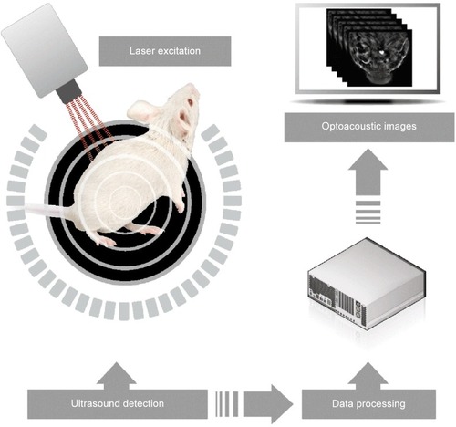 Figure 4 Depiction of the mechanism of optoacoustic imaging.Note: Copyright © 2015. Reproduced with permission from iThera Medical, (http://www.ithera-medical.com/technology/msot-principle.html).Citation114