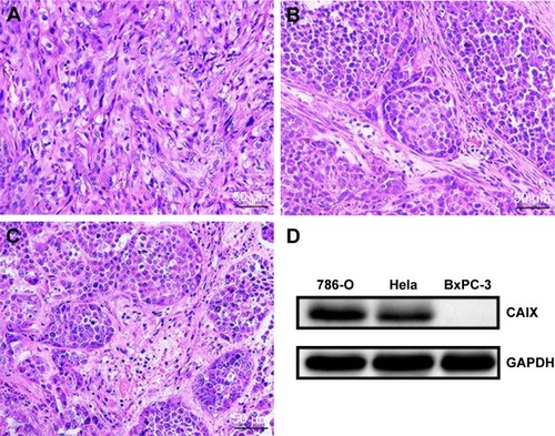 Figure 10 H&E staining and CAIX expression of xenograft tumor tissues.Notes: (A) 786-O xenograft tumor tissues stained with H&E. (B) Hela xenograft tumor tissues stained with H&E. (C) BxPC-3 xenograft tumor tissues stained with H&E. (D) Expression of CAIX in xenograft tumor tissues.Abbreviations: CAIX, carbonic anhydrase IX; GAPDH, glyceraldehyde-3-phosphate dehydrogenase.