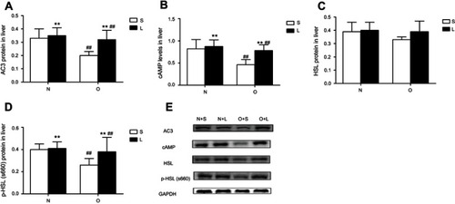 Figure 1 AC3, hormone-sensitive lipase (HSL) and p-HSL(S660) expression at the protein levels and cAMP levels in the liver after treatment with liraglutide or saline. Values are means ± SD (n=6 per group). A 2×2 factorial analysis was used to analyse differences. (A–D) present the levels of AC3 protein, cAMP, HSL protein and p-HSL(S660) protein, respectively, in the liver tissues of mice after treatment with liraglutide or saline. The P-value of the interaction between obesity and liraglutide treatment for AC3 protein, cAMP, HSL protein and p-HSL(S660) protein levels in the livers are 0.049, 0.044, 0.354 and 0.049, respectively. (E) Western blots show hepatic AC3, cAMP, HSL and p-HSL (S660) levels.